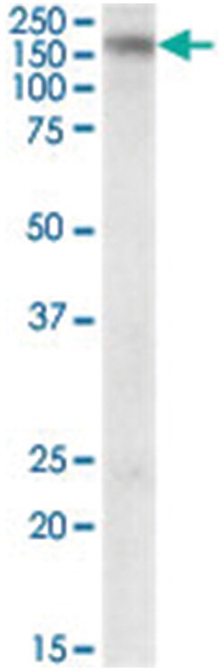 KALRN, Goat, Polyclonal Antibody, Abnova 100&mu;g; Unlabeled:Antibodies,