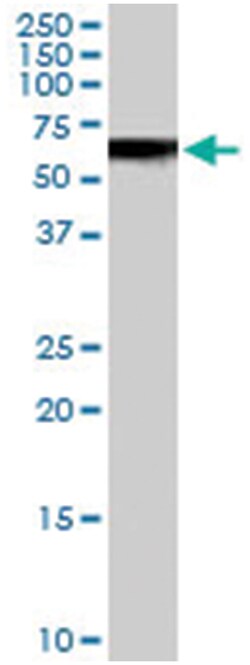 VPS45 Goat anti-Human, Polyclonal Antibody, Abnova 100 &mu;g | Buy Online | Abnova | Fisher Scientific