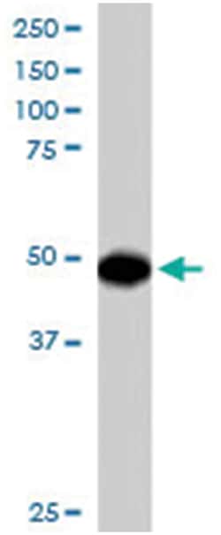 OSBPL1A, Goat, Polyclonal Antibody, Abnova 100 &mu;g | Buy Online | Abnova Corporation | Fisher Scientific