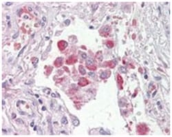 OSBPL9, Goat, Polyclonal Antibody, Abnova 100 &mu;g | Buy Online | Abnova Corporation | Fisher Scientific