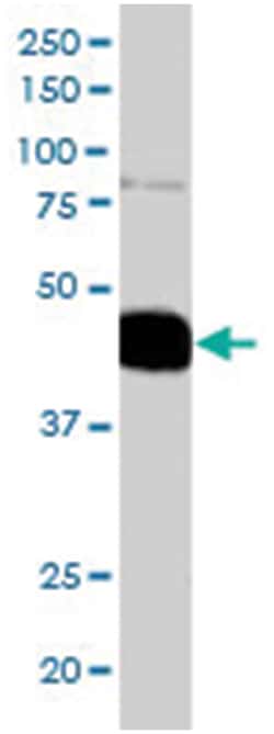 PLEK, Goat, Polyclonal Antibody, Abnova 100 &mu;g | Buy Online | Abnova Corporation | Fisher Scientific