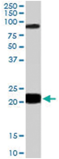 RASAL1, Goat, Polyclonal Antibody, Abnova 100 &mu;g | Buy Online | Abnova Corporation | Fisher Scientific