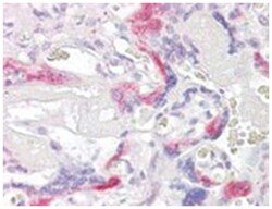 PHLDA2, Goat, Polyclonal Antibody, Abnova 100 &mu;g | Buy Online | Abnova Corporation | Fisher Scientific