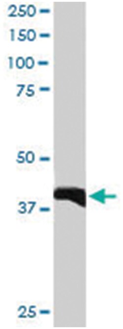 GIPC3, Goat, Polyclonal Antibody, Abnova 100&mu;g; Unlabeled:Antibodies,