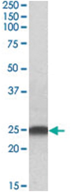 LIN7B, Goat, Polyclonal Antibody, Abnova 100 &mu;g | Buy Online | Abnova Corporation | Fisher Scientific