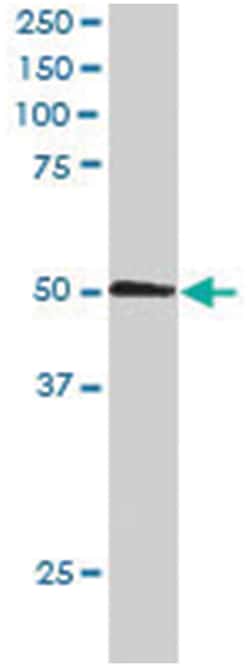 SNX5, Goat, Polyclonal Antibody, Abnova 100 &mu;g | Buy Online | Abnova Corporation | Fisher Scientific