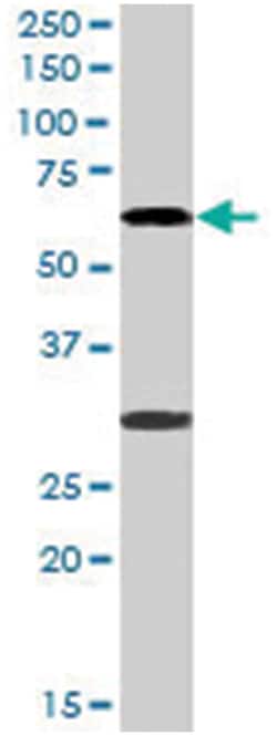 MPP6, Goat, Polyclonal Antibody, Abnova 100&mu;g; Unlabeled:Antibodies,