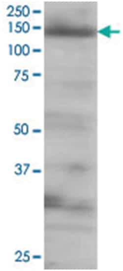 EIF4ENIF1, Goat, Polyclonal Antibody, Abnova 100 &mu;g | Buy Online | Abnova Corporation | Fisher Scientific