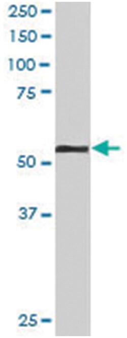 KPNA2, Goat, Polyclonal Antibody, Abnova 100 &mu;g | Buy Online | Abnova | Fisher Scientific
