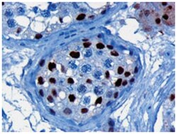 KPNA4, Goat, Polyclonal Antibody, Abnova 100 &mu;g | Buy Online | Abnova Corporation | Fisher Scientific
