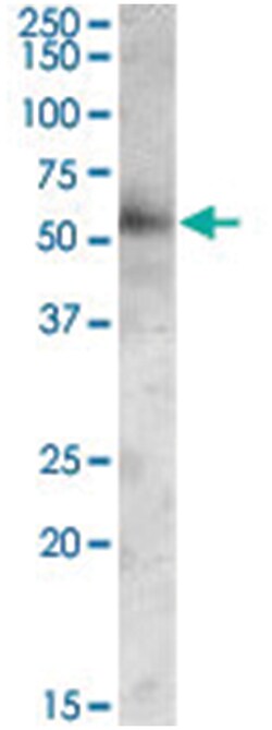 GOPC, Goat, Polyclonal Antibody, Abnova 100 &mu;g | Buy Online | Abnova Corporation | Fisher Scientific