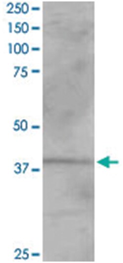 VPS26A, Goat, Polyclonal Antibody, Abnova 100 &mu;g | Buy Online | Abnova | Fisher Scientific