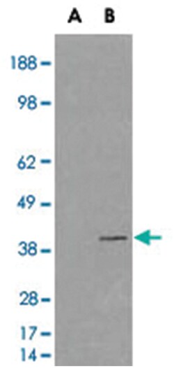 VPS26A, Goat, Polyclonal Antibody, Abnova 100 &mu;g | Buy Online | Abnova | Fisher Scientific