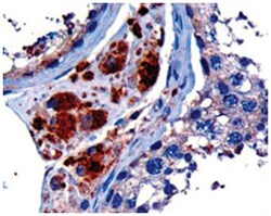 STK35, Goat, Polyclonal Antibody, Abnova 100 &mu;g | Buy Online | Abnova Corporation | Fisher Scientific