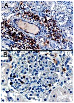 SH3BP1, Goat, Polyclonal Antibody, Abnova 100 &mu;g | Buy Online | Abnova Corporation | Fisher Scientific