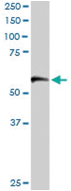 TCP1, Goat, Polyclonal Antibody, Abnova 100&mu;g; Unlabeled:Antibodies,