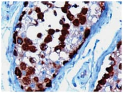 TCP1, Goat, Polyclonal Antibody, Abnova 100&mu;g; Unlabeled:Antibodies,