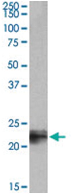 TAGLN, Goat, Polyclonal Antibody, Abnova 100 &mu;g | Buy Online | Abnova Corporation | Fisher Scientific