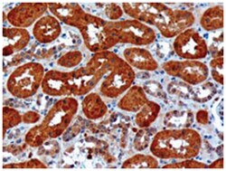 USH1C, Goat, Polyclonal Antibody, Abnova 100&mu;g; Unlabeled:Antibodies,