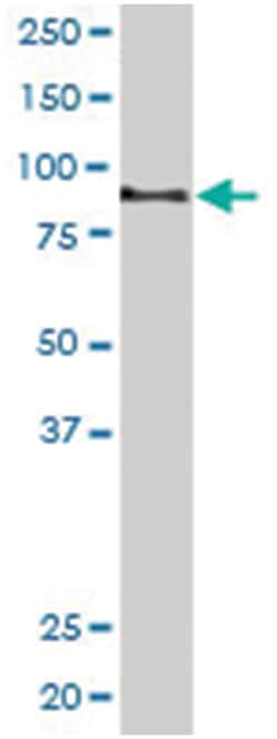 AKAP3, Goat, Polyclonal Antibody, Abnova 100 &mu;g | Buy Online | Abnova | Fisher Scientific