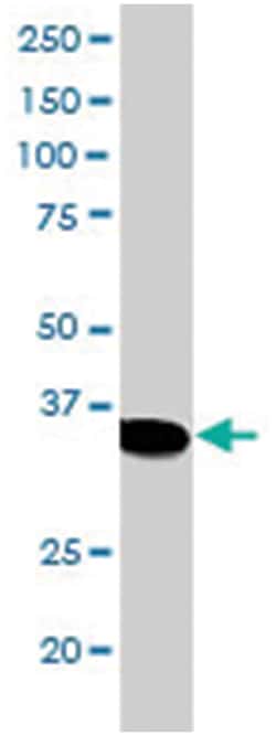 SMUG1, Goat, Polyclonal Antibody, Abnova 100 &mu;g | Buy Online | Abnova Corporation | Fisher Scientific