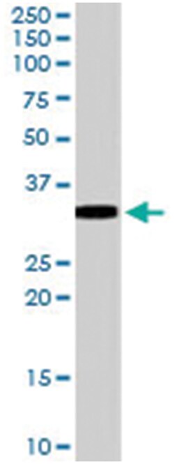 VDAC2 Goat anti-Human, Rat, Polyclonal Antibody, Abnova 100 &mu;g | Buy Online | Abnova Corporation | Fisher Scientific