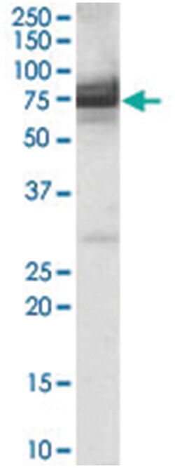 IFT74, Goat, Polyclonal Antibody, Abnova 100&mu;g; Unlabeled:Antibodies,
