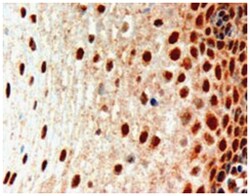 PAX3, Goat, Polyclonal Antibody, Abnova 100 &mu;g | Buy Online | Abnova Corporation | Fisher Scientific