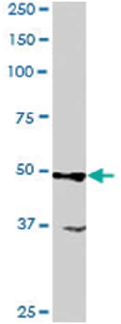 ACTL6A/ACTL6B, Goat, Polyclonal Antibody, Abnova 100&mu;g; Unlabeled:Antibodies,
