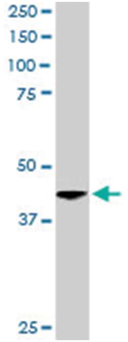 ACTR1A, Goat, Polyclonal Antibody, Abnova 100&mu;g; Unlabeled:Antibodies,