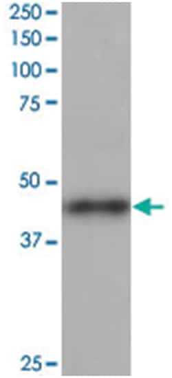 ACTR1B, Goat, Polyclonal Antibody, Abnova 100&mu;g; Unlabeled:Antibodies,