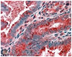 ACTR1B, Goat, Polyclonal Antibody, Abnova 100&mu;g; Unlabeled:Antibodies,