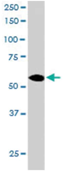 CORO1C, Goat, Polyclonal Antibody, Abnova 100 &mu;g | Buy Online | Abnova Corporation | Fisher Scientific