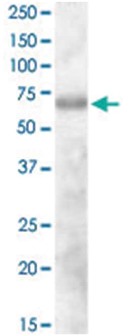 DEF6, Goat, Polyclonal Antibody, Abnova 100μg; Unlabeled:Antibodies,