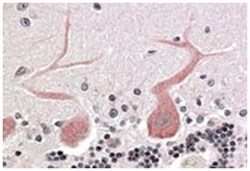 CDC42BPA, Goat, Polyclonal Antibody, Abnova 100 &mu;g | Buy Online | Abnova Corporation | Fisher Scientific