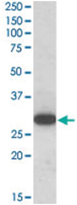 RGS18, Goat, Polyclonal Antibody, Abnova 100 &mu;g | Buy Online | Abnova Corporation | Fisher Scientific