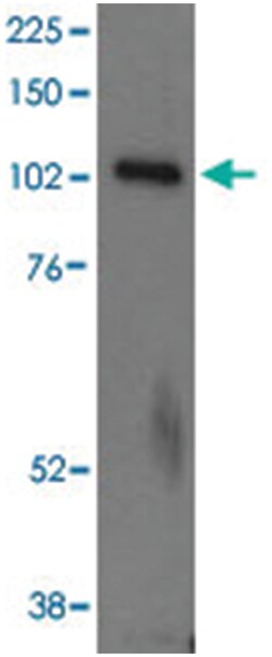 UNC13D Goat anti-Human, Polyclonal Antibody, Abnova 100 &mu;g | Buy Online | Abnova Corporation | Fisher Scientific