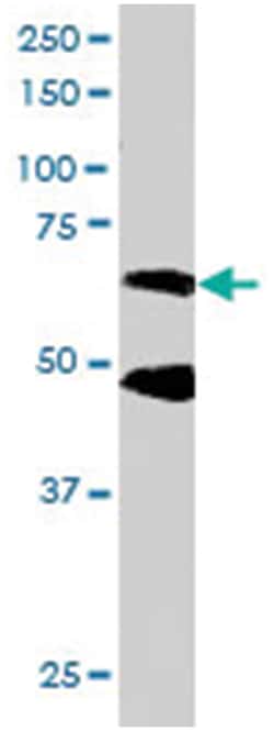 CPEB1, Goat, Polyclonal Antibody, Abnova 100&mu;g; Unlabeled:Antibodies,