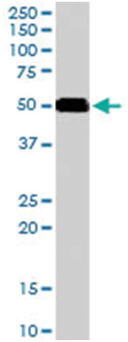 CD2BP2, Goat, Polyclonal Antibody, Abnova 100&mu;g; Unlabeled:Antibodies,