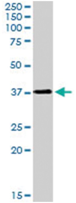 LAT, Goat, Polyclonal Antibody, Abnova 100 &mu;g | Buy Online | Abnova Corporation | Fisher Scientific
