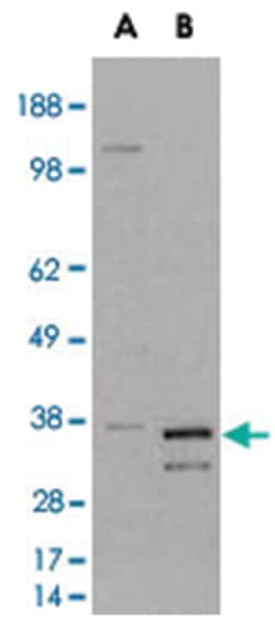 PIR, Goat, Polyclonal Antibody, Abnova 100&mu;g; Unlabeled:Antibodies,