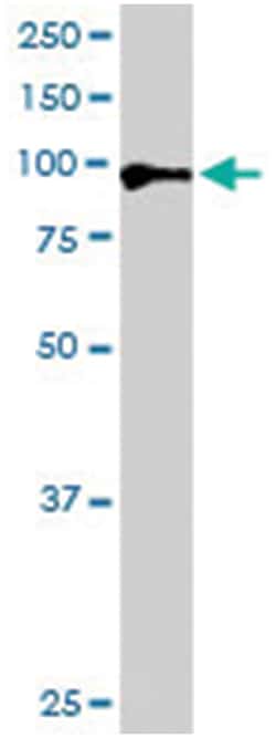 AR, Goat, Polyclonal Antibody, Abnova 100&mu;g; Unlabeled:Antibodies, Polyclonal