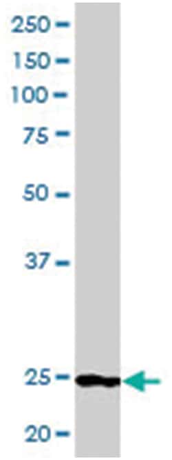 BCL2, Goat, Polyclonal Antibody, Abnova 100 &mu;g | Buy Online | Abnova | Fisher Scientific