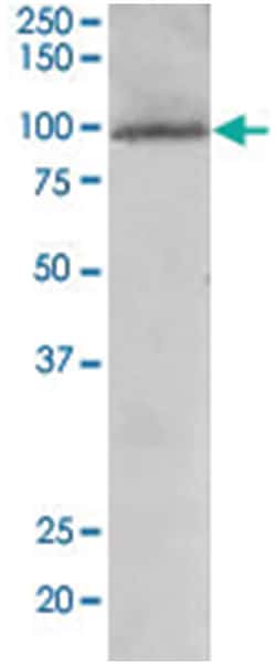 TAOK3, Goat, Polyclonal Antibody, Abnova 100 &mu;g | Buy Online | Abnova Corporation | Fisher Scientific