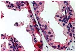 TAOK3, Goat, Polyclonal Antibody, Abnova 100 &mu;g | Buy Online | Abnova Corporation | Fisher Scientific