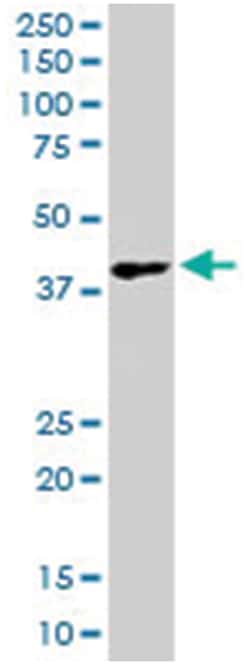 DKK1, Goat, Polyclonal Antibody, Abnova 100 &mu;g | Buy Online | Abnova Corporation | Fisher Scientific