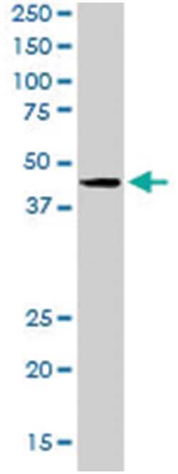 SAMSN1, Goat, Polyclonal Antibody, Abnova 100 &mu;g | Buy Online | Abnova Corporation | Fisher Scientific