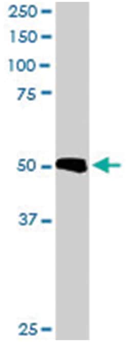 TXNDC5 Goat anti-Human, Polyclonal Antibody, Abnova 100 &mu;g | Buy Online | Abnova Corporation | Fisher Scientific