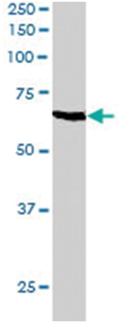 ANTXR1, Goat, Polyclonal Antibody, Abnova 100&mu;g; Unlabeled:Antibodies,