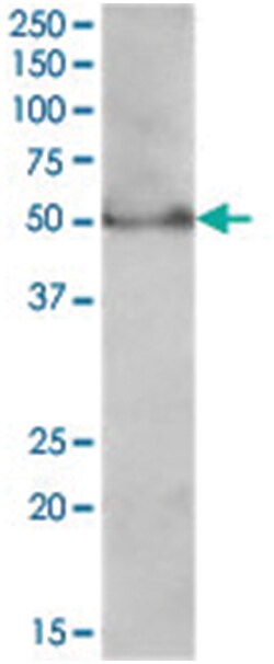 PPARD, Goat, Polyclonal Antibody, Abnova 100 &mu;g | Buy Online | Abnova Corporation | Fisher Scientific